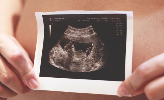 Ultrasound - The Out Of My Mind Blog
